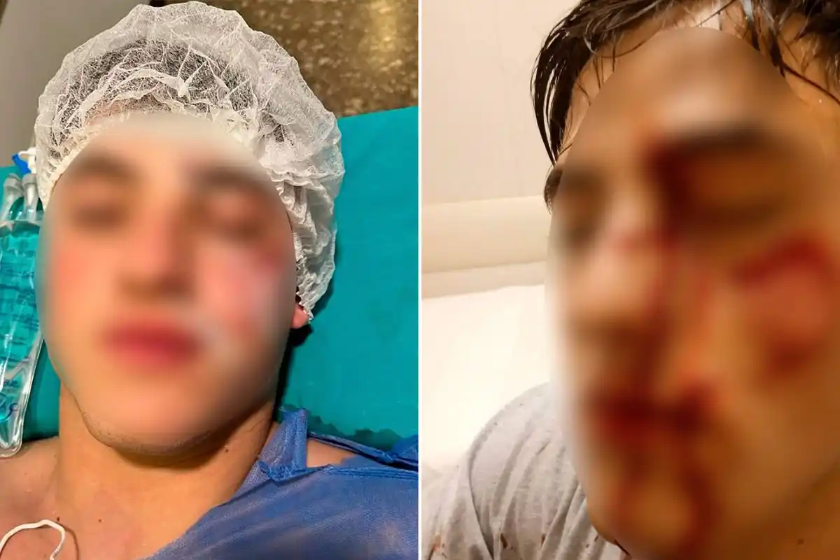 La víctima perdió un ojo y quedó con cicatrices permanentes debido a la brutal agresión.