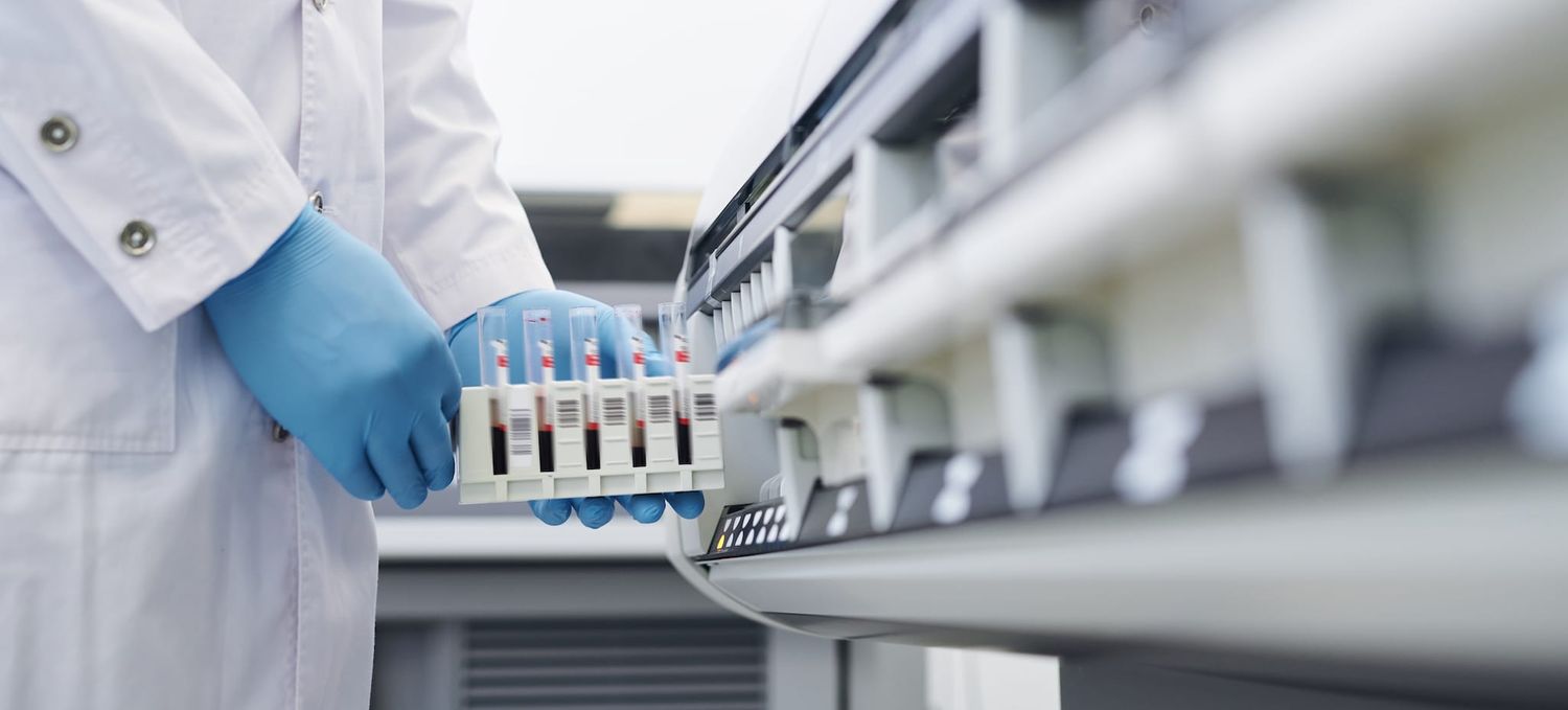Segunda ola de coronavirus: el índice de positividad alcanzó el 60 %