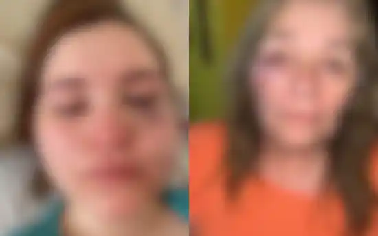 Denuncian brutal ataque en Brown: Golpeó a su novia, noqueó a su suegra y lastimó a un bebé