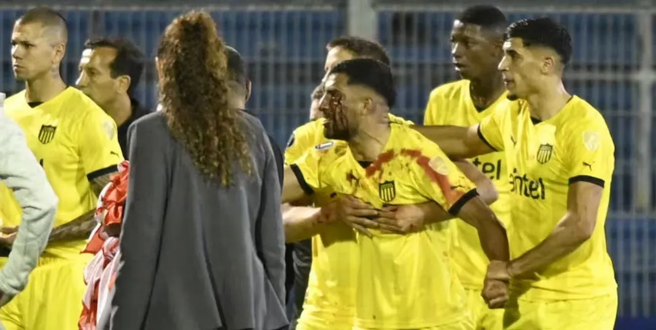 El futbolista quedó sangrando y enloqueció contra los hinchas locales.