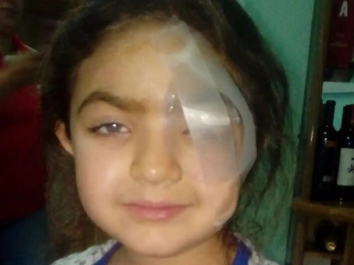 Camila Pizarro logró mejorar su visión tras un trasplante de córnea