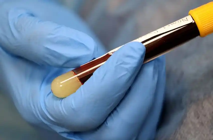 Un estudio revela que el grupo sanguíneo puede determinar el riesgo de fallo respiratorio por coronavirus