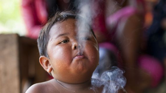 Así está hoy el bebé que fumaba 40 cigarrillos por día y su caso impactó al mundo entero
