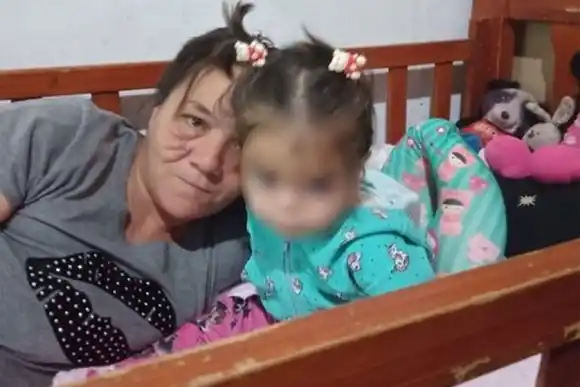 La beba atacada por perros pitbull en barrio Santa Rosa de Lima recibió el alta