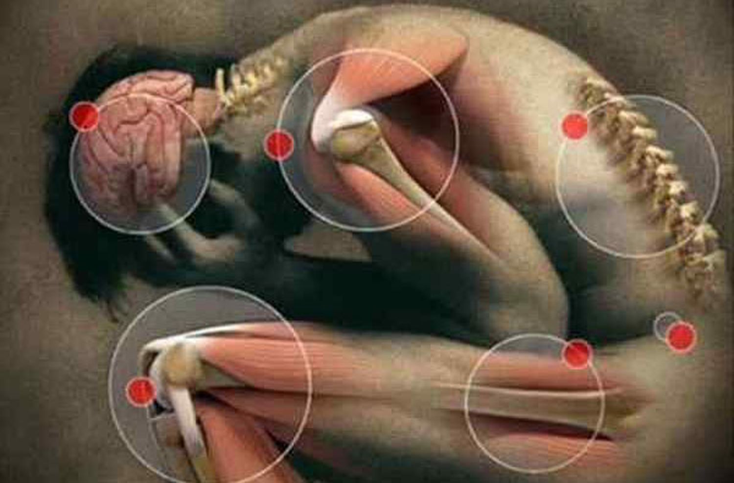 Fibromialgia: ¿cómo mejorar la vida de quienes la padecen?
