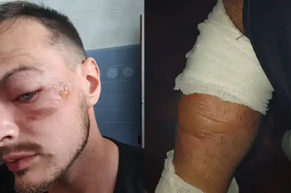 "Hoy volví a nacer": Quedó atrapado entre un alambrado y un incendio y lo salvó un compañero