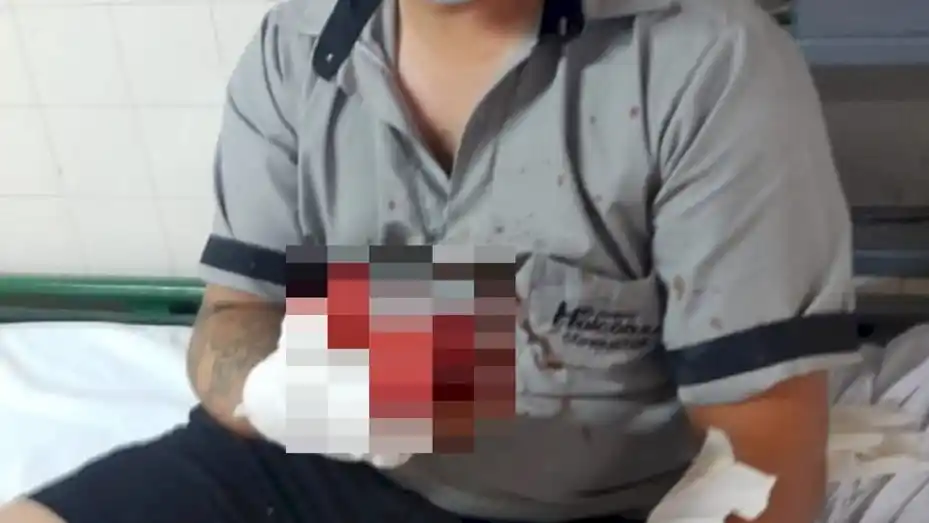 Acusó a un colectivero por una infidelidad y le amputó el dedo