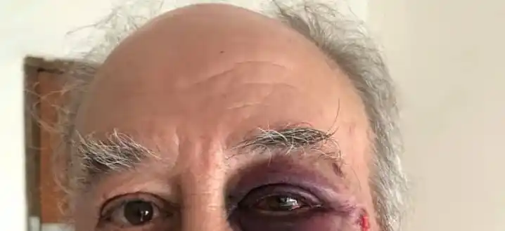 Violento robo en un hotel céntrico: golpearon con violencia al dueño