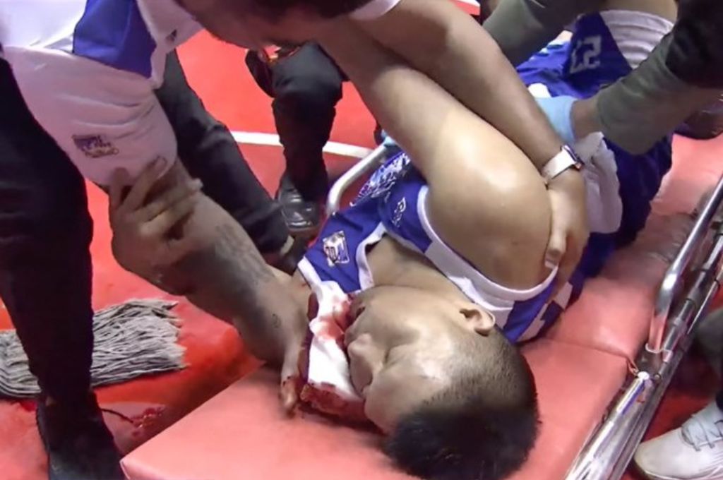 Jugador golpeado