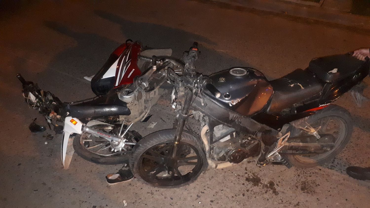 Los motociclistas que chocaron de frente por esquivar reductores de velocidad sufrieron diversas fracturas