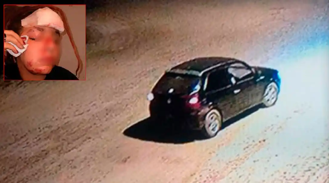 Urdinarrain: un auto chocó a una joven en bicicleta y se dio a la fuga