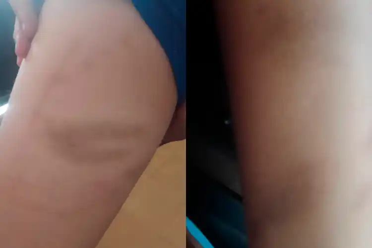 Niño de 12 años fue azotado con un cable por su padre