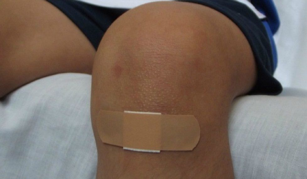 ¿Qué hacer y qué no frente a accidentes frecuentes?