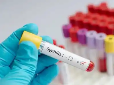 Confirman un aumento progresivo de casos de sífilis en Rosario