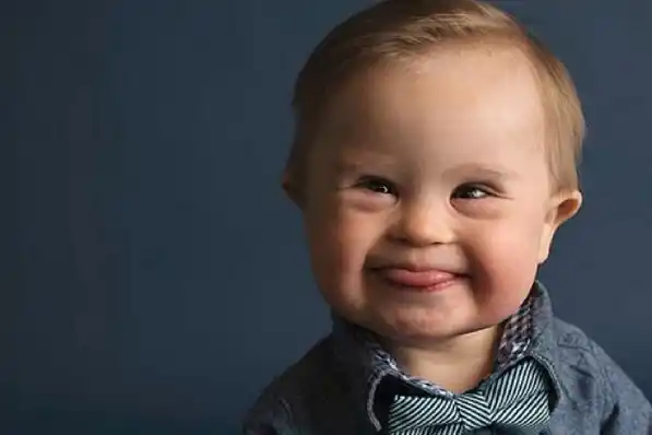 “Ningún bebé con síndrome de Down puede ser descartado”