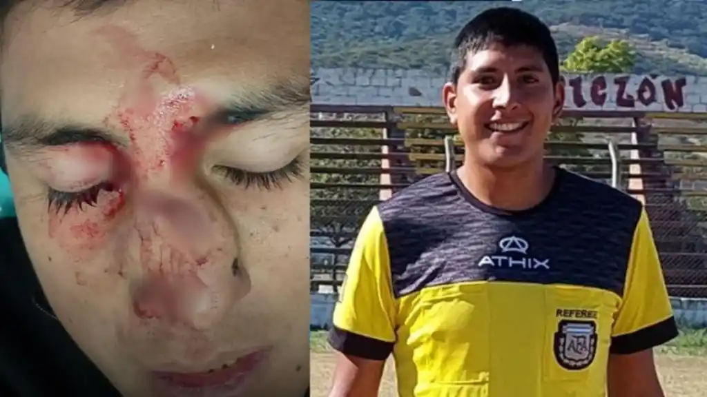 El juez sufrió la fractura de su nariz