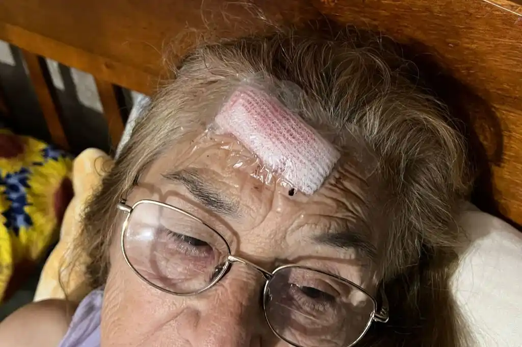 Rosa, víctima del robo