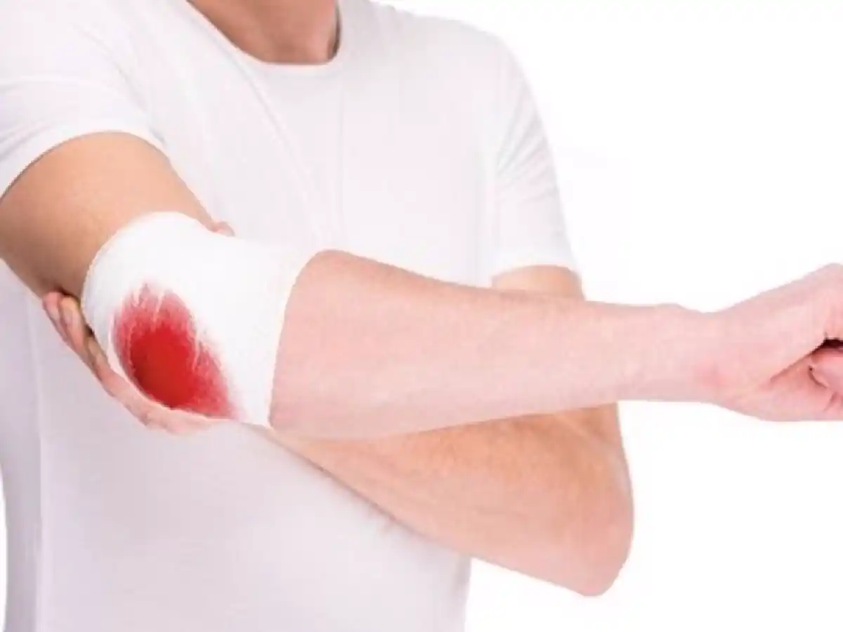 Autorizan nuevo medicamento para personas con hemofilia A