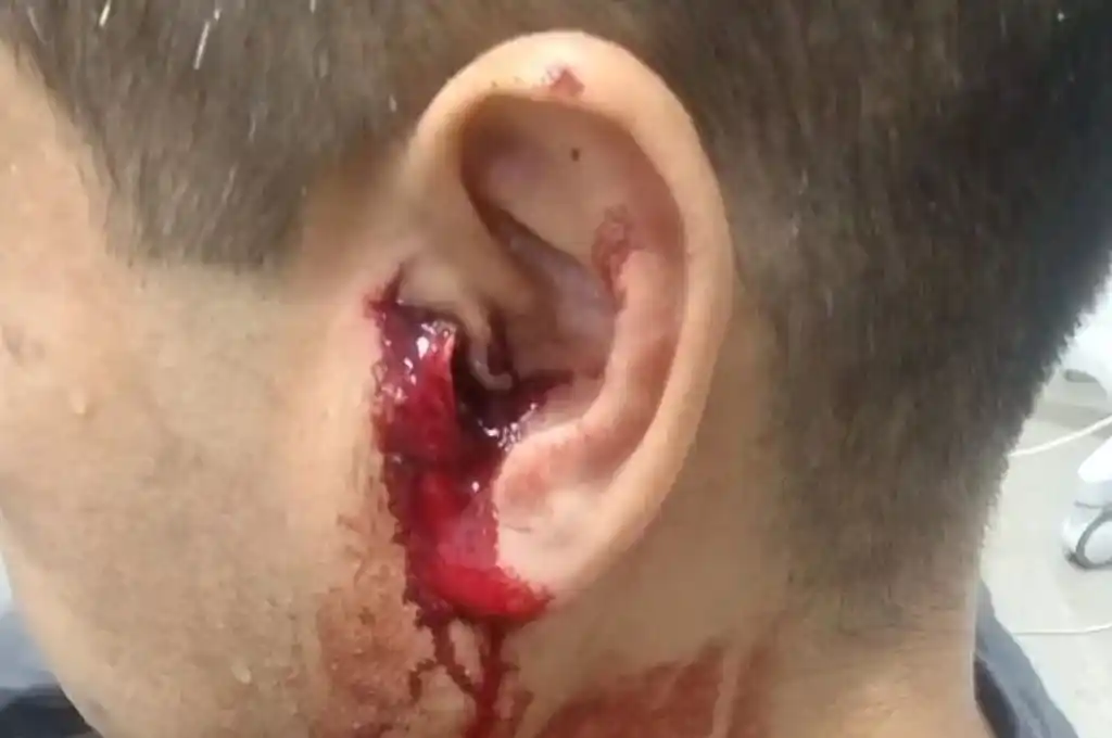 Escándalo en la Liga Rafaelina de Fútbol: clásico suspendido por peleas y violencia