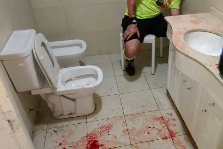 En Pergamino, tres árbitros fueron agredidos brutalmente por hinchas de Juventud