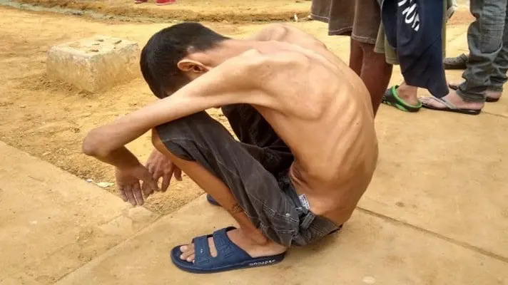 ¡TERRIBLE! 117 presos en el retén de Cabimas sufren de tuberculosis