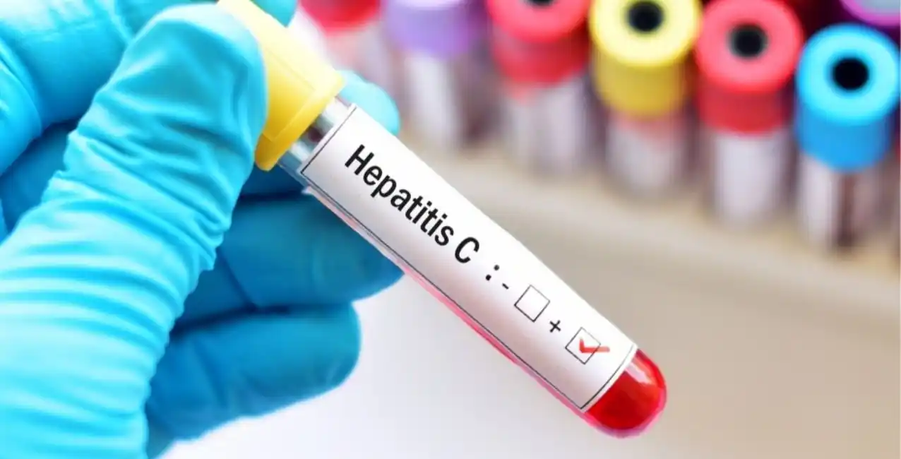 La ANMAT aprobó un test rápido para la detección del virus de la hepatitis C
