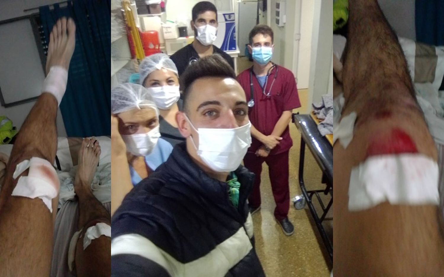 Se accidentó DJ Peppo en ruta 1001: un perro se le cruzó y lo hizo caer de la moto