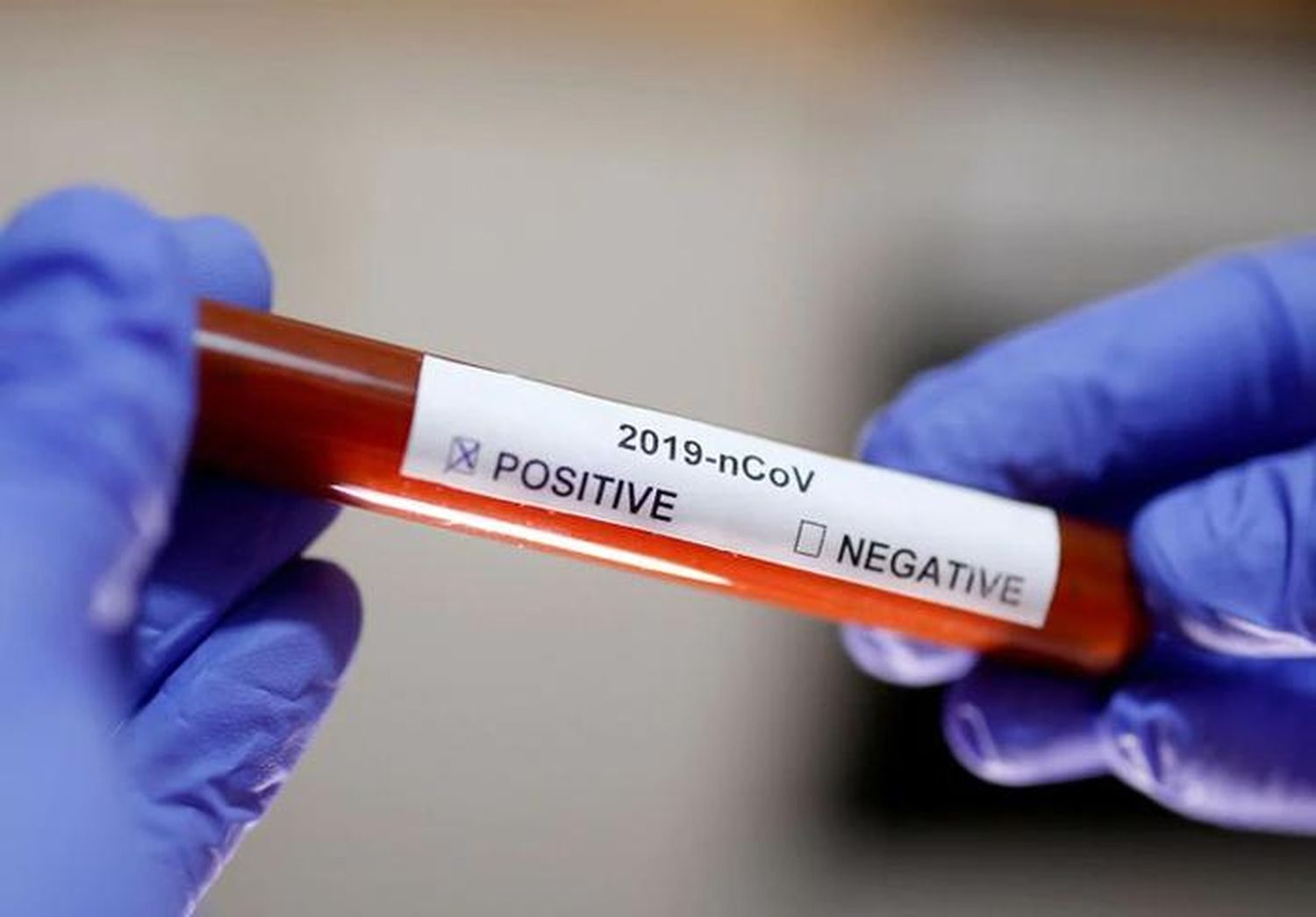 El Ministerio de Salud  informó un nuevo infectado de  coronavirus en Gualeguaychú