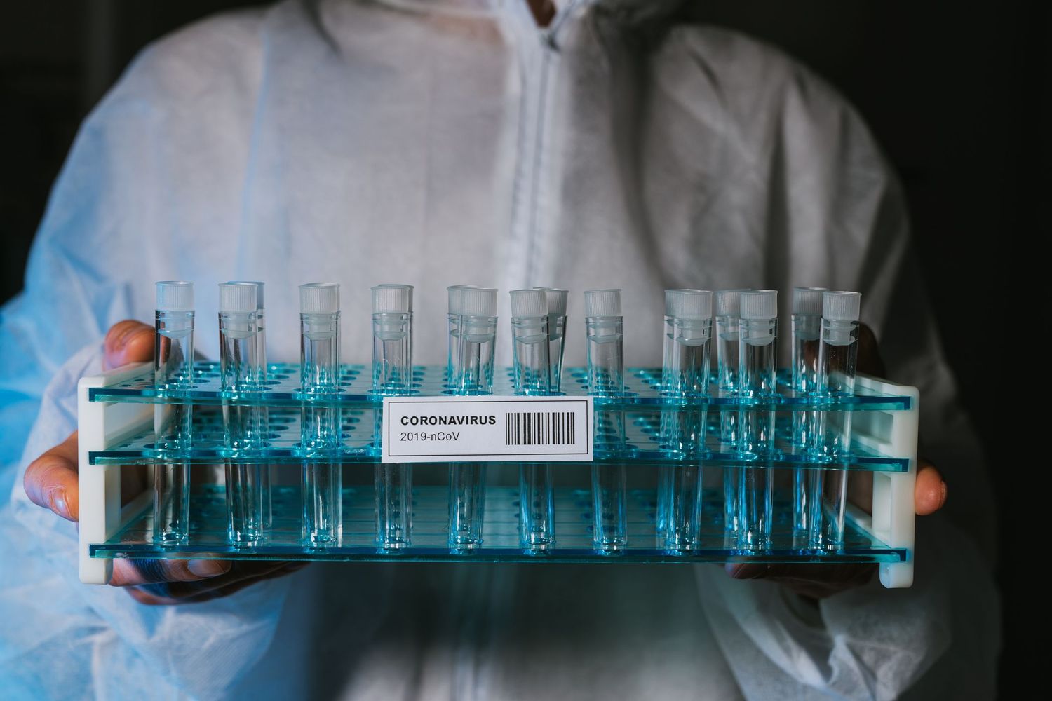 Coronavirus: confirman otros 5 casos positivos para San Pedro