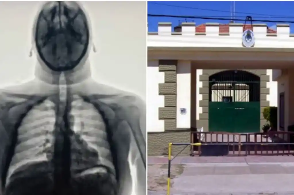 Con modernos body scan, descubrieron a presos que habían tomado cápsulas con droga en las visitas. (Video: X/ @PatoBullrich).