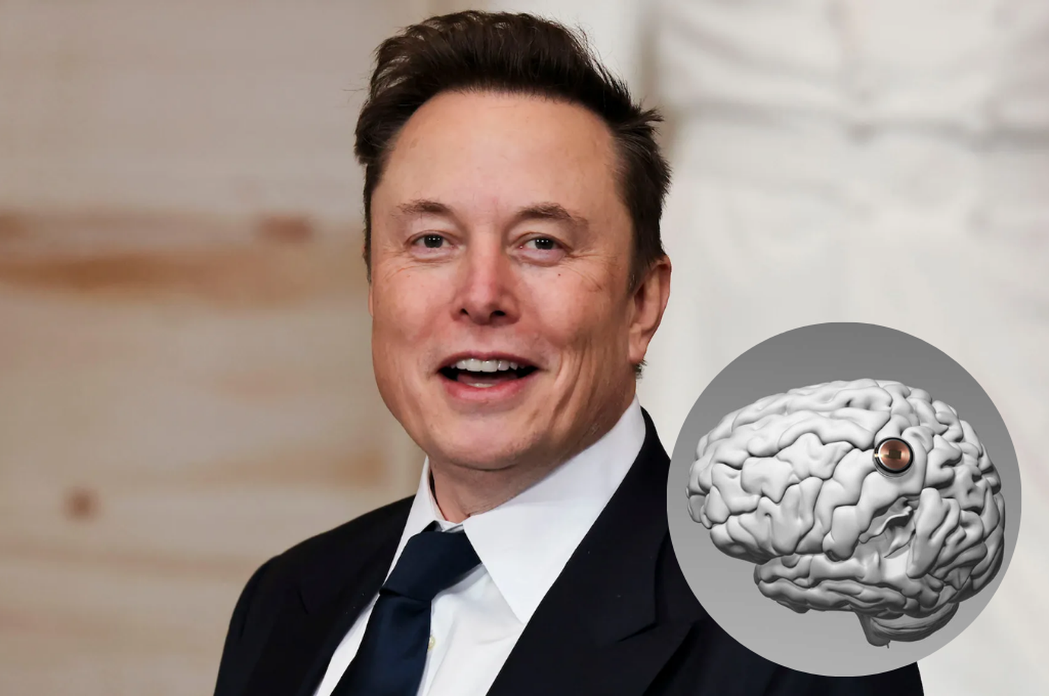 Elon Musk anunció el fin de los celulares: así funcionaría su chip cerebral