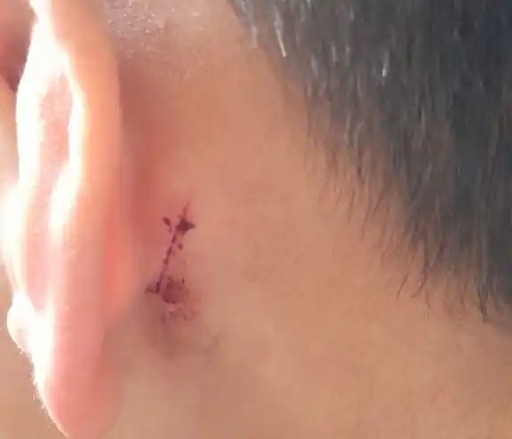 El niño recibirá asistencia psicológica particular. La mamá se reunió con autoridades que le ofrecieron cambiarlo de establecimiento.