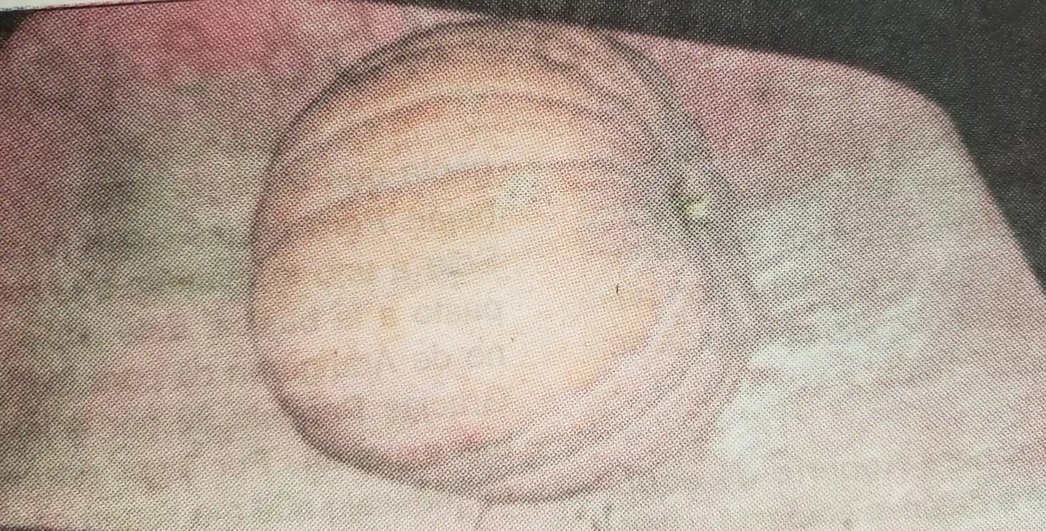 El zapallazo de don Walter