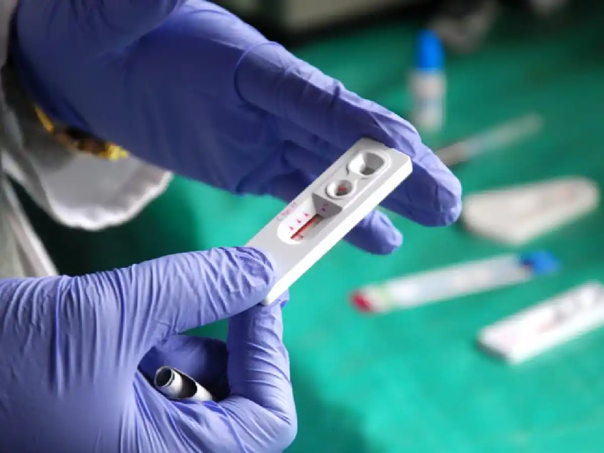 Onusida estimó 7,7 millones de muertes relacionadas con el sida en los próximos 10 años