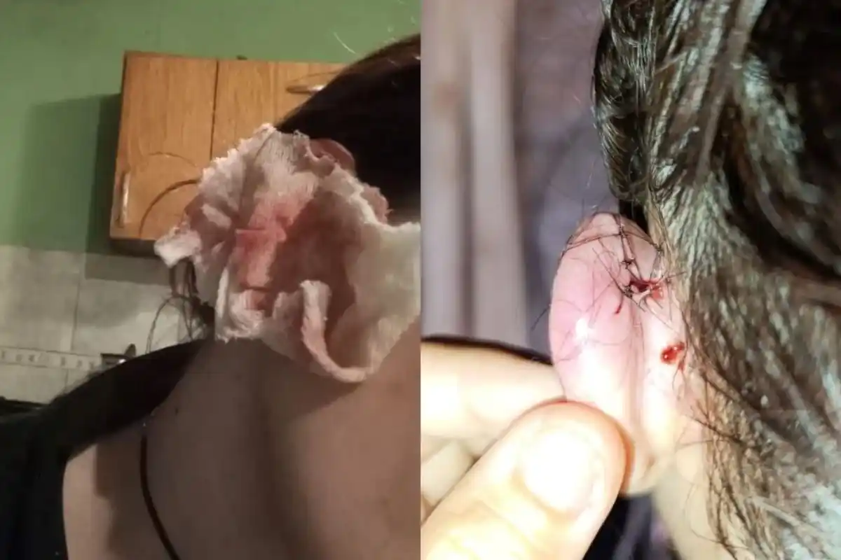 La víctima tiene 19 años.