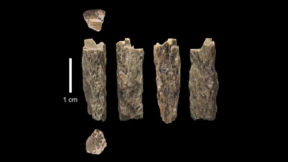 Descubierta la primera humana fruto del sexo entre dos especies distintas