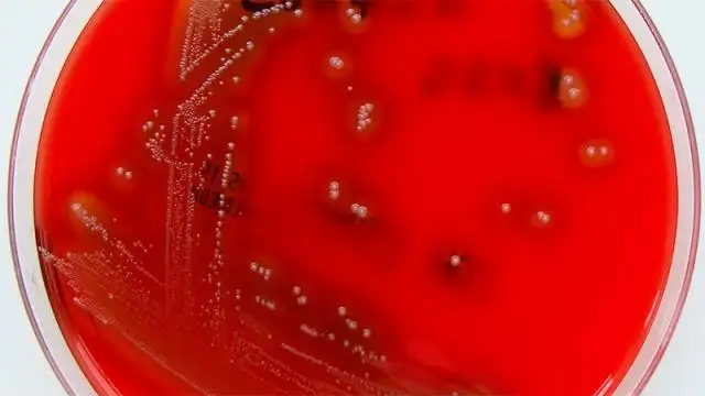 Ratifican que la bacteria del estreptococo "no adquirió genes de más virulencia"