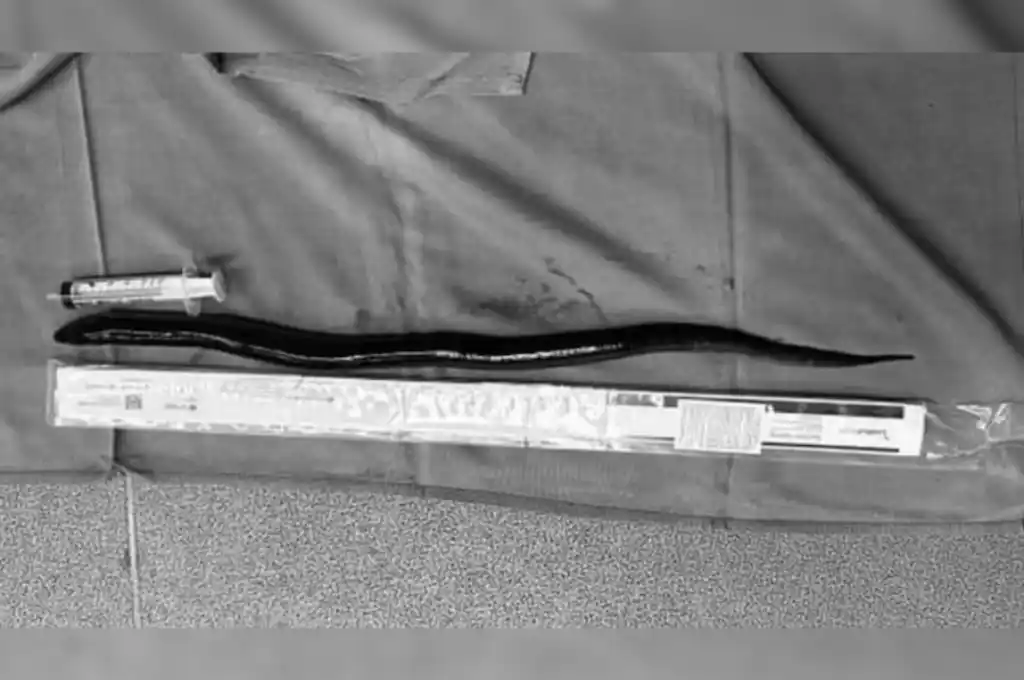 La operación fue un éxito y el paciente se encuentra en proceso de recuperación.