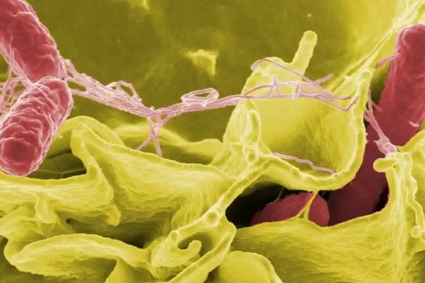 tuberculosis