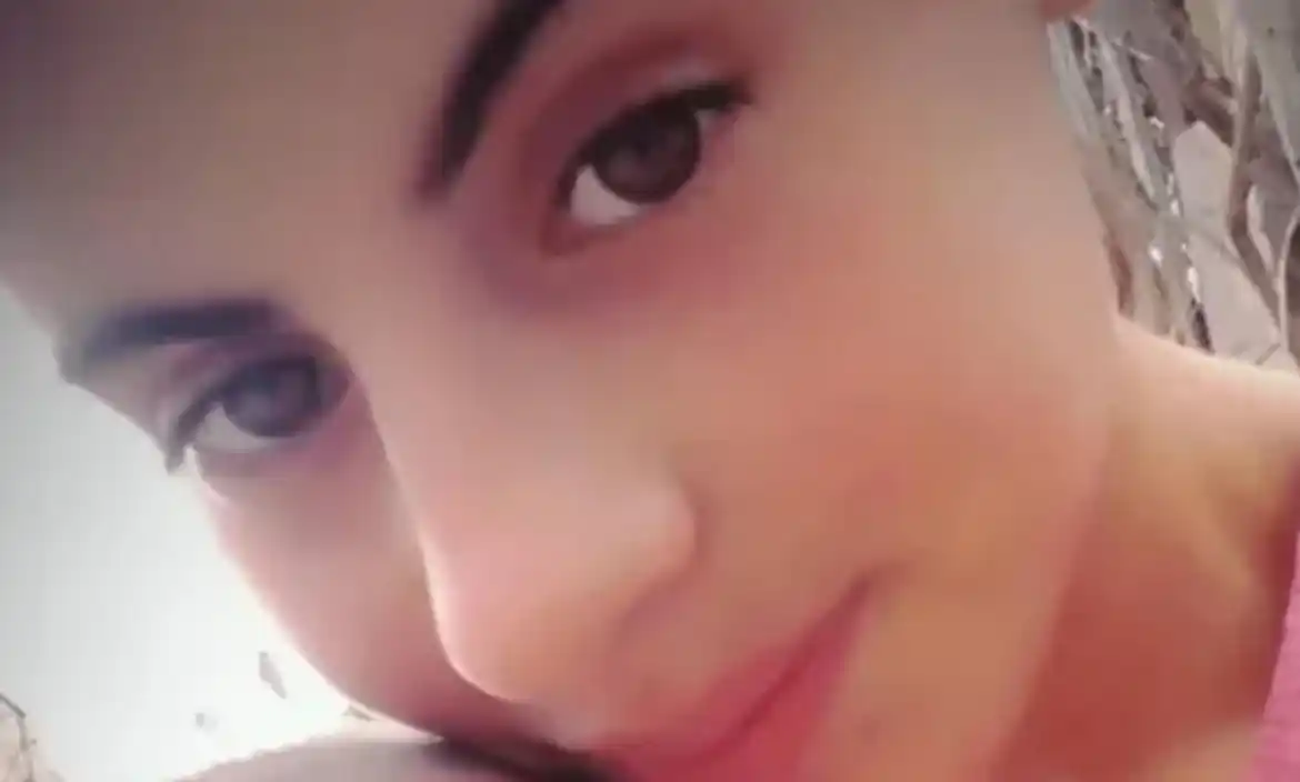 Dieron de alta a la joven que había sido prendida fuego por su novio