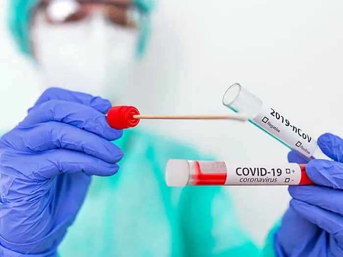Desde el inicio de la pandemia, se hicieron 12.042 testeos