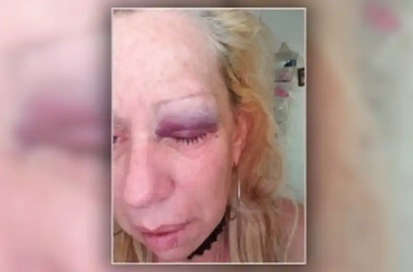 Una mujer denunció 40 veces a su ex marido por violencia de género y pide que lo detengan