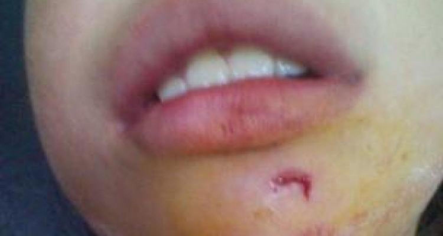 Balean a niña de 8 años
