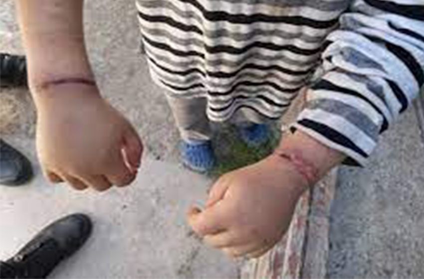 Moreno: rescataron a dos menores que eran atados como perros