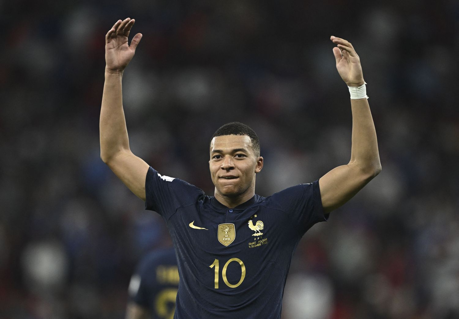 En Francia, cuidan a Mbappé