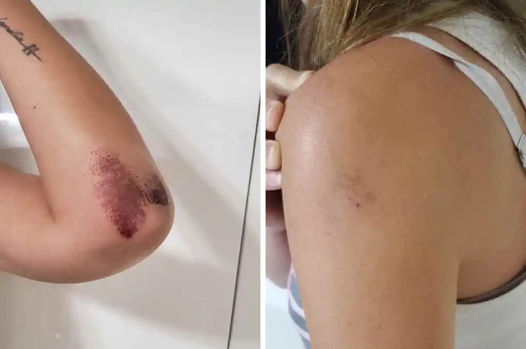 La atropellaron para robarle la bicicleta