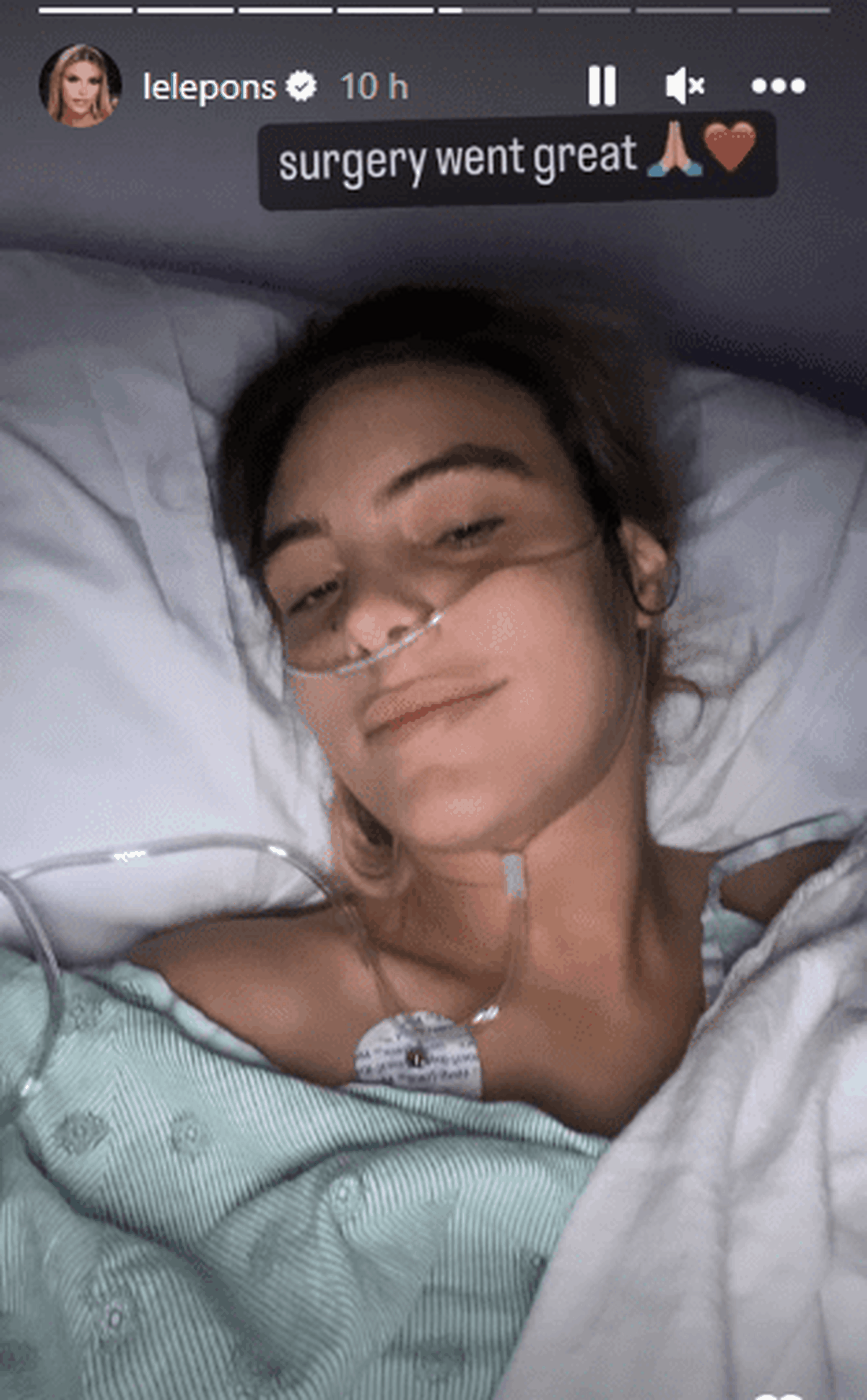 Lele Pons compartió el resultado de su operación. Foto Instagram