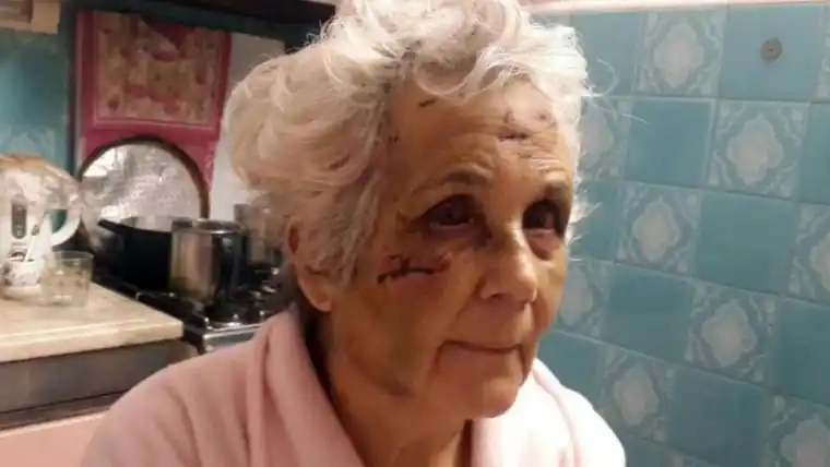 Una mujer de 73 años fue desfigurada por su pareja