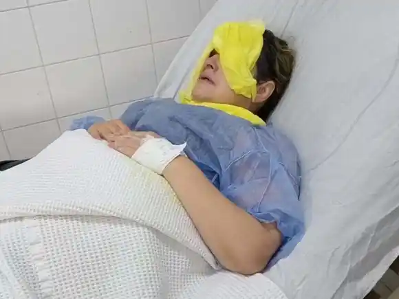 Ataque en el Masvernat: una mujer sufrió lesiones tras recibir un líquido corrosivo en el rostro