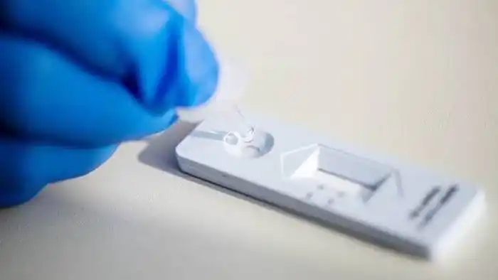 Por qué hacerse un test de antígenos para salir de fiesta, no evita el riesgo de covid-19